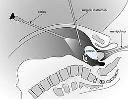 Miniature piezoelectric motor integrated into endoscope tip for articulation control